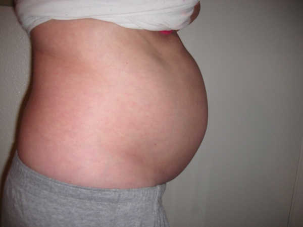 Bloating Pregnant 115