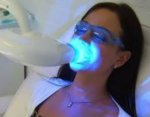 Teeth Whitening at home