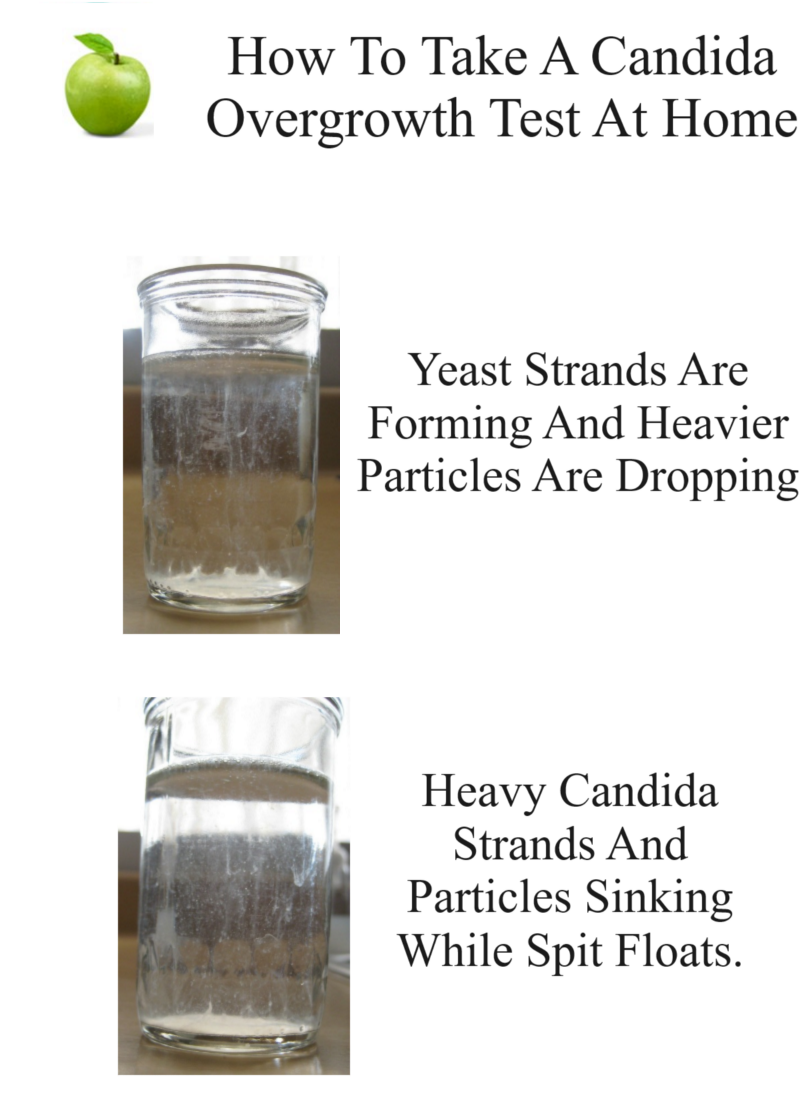 How Accurate is the Candida Spit Test?
Precisely follow these steps and you will get true results. A Candida home test is accurate to the point of letting you know you have an overgrowth problem.