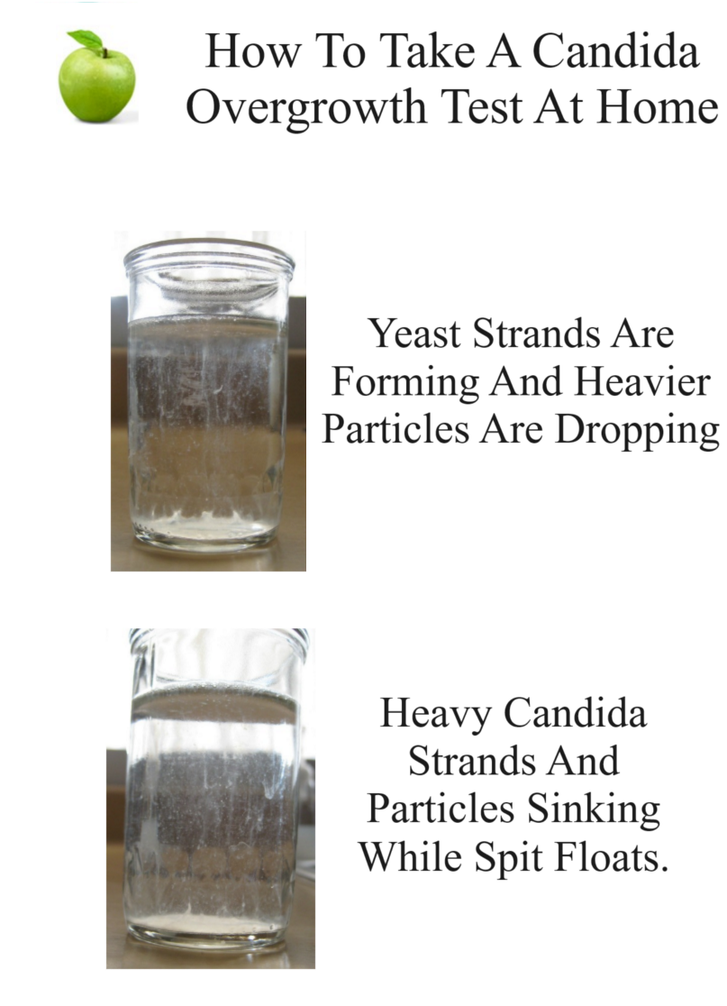 Candida Overgrowth Home Test Do you suspect you have a Candida Infection? Learn how to take this free Candida home test and understand what your test results mean.