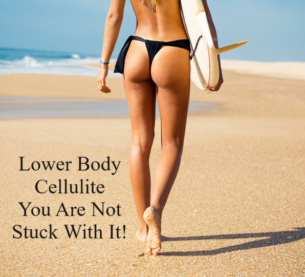 Lower Body Cellulite, How to Get Rid Of It! You Are Not Stuck With It. Target cellulite trouble zones; bring back the smooth, tight and sexy appearance in your butt, hips, thighs and legs.