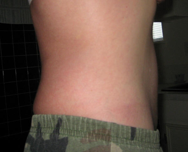 Got Rid of My Extreme Bloating and Do Not Bloat Anymore!