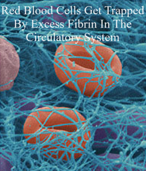 Excess Fibrin causes physical restrictions of blood flow which causes inflammation and other systemic problems. This is why it is important to remove the excess fibrin from your body.